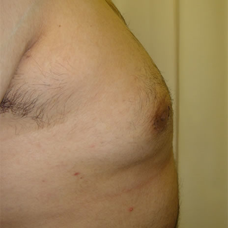 2 frontal right post