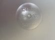 breast Implant Philip Turton Cosmetic Breast Surgeon Leeds