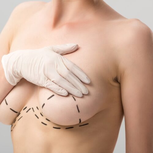 cropped view of woman in latex glove with marks on breast isolated on grey