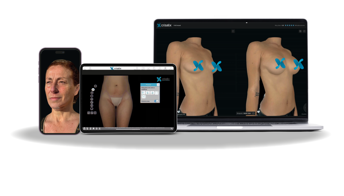 Crisalix 3D imaging consultation for breast surgery