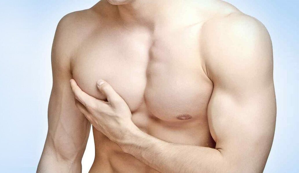 Male breast reduction surgery for gynaecomastia